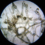 Mildew Resistance Mildew Resistance